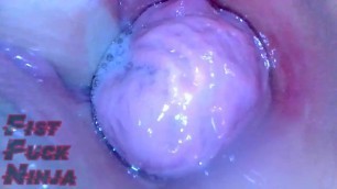 Juicy Japanese Pussy Endoscope View